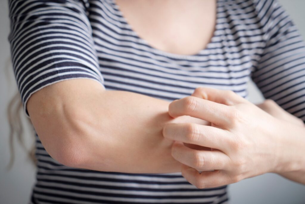 Masz dość uporczywych plam na skórze? Odkryj sprawdzony sposób na trwałe pożegnanie z łupieżem pstrym!