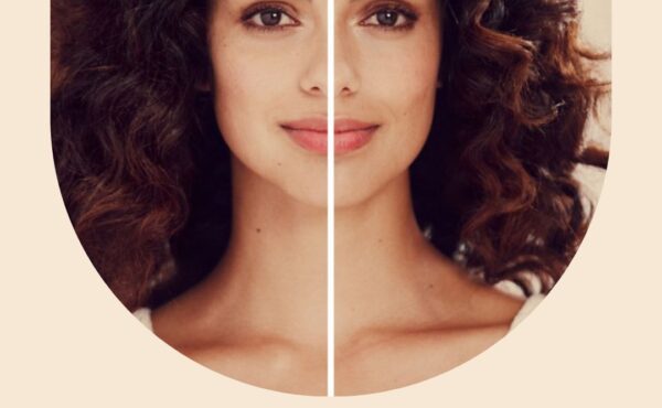 Dlaczego włosy się puszą?