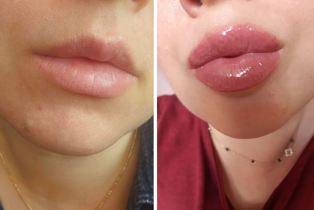 „Hit Makijażowy 2025! Ten Sekretny Składnik Sprawia, że Twoje Usta Wyglądają Pełniej i Seksowniej!”