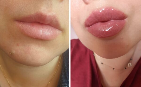„Hit Makijażowy 2025! Ten Sekretny Składnik Sprawia, że Twoje Usta Wyglądają Pełniej i Seksowniej!”