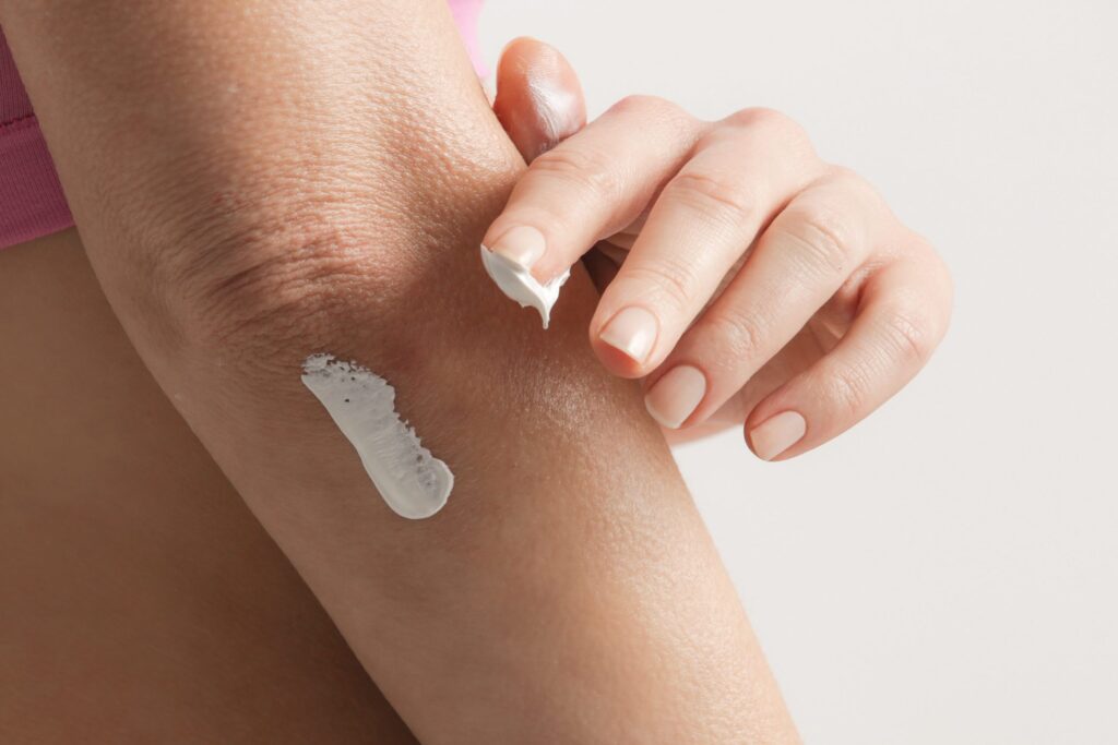 Zmagasz się z szorstką skórą? Oto zaskakujące powody, o których nikt Ci nie powiedział!