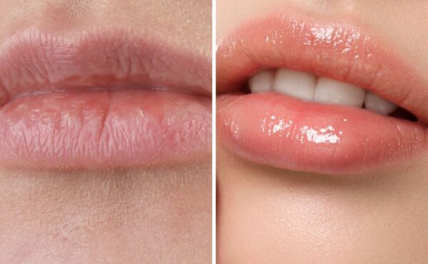 Nie uwierzysz, jak pozbyłam się szorstkich ust! Teraz są miękkie, soczyste i pełne zmysłowego blasku – musisz to wypróbować!