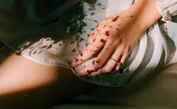 Kolagen – jak działa na mięśnie, skórę i stawy?