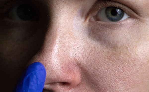 Rozszerzone pory – te sposoby cię uratują!