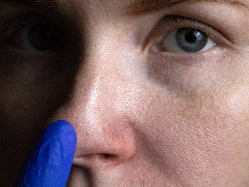 Rozszerzone pory – te sposoby cię uratują!