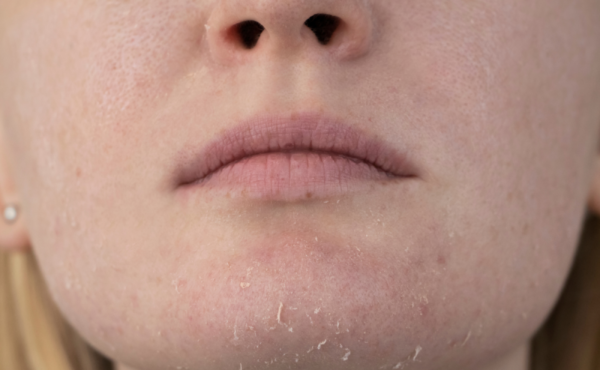 Czy oczyszczanie twarzy może być szkodliwe? I to jak!